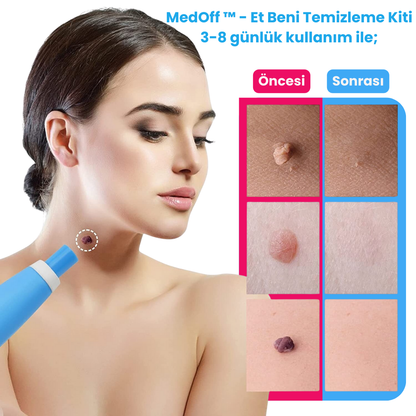 MedOff ™ - Et Beni Temizleme Kiti