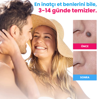 MedOff ™ - Et Beni Temizleme Kiti