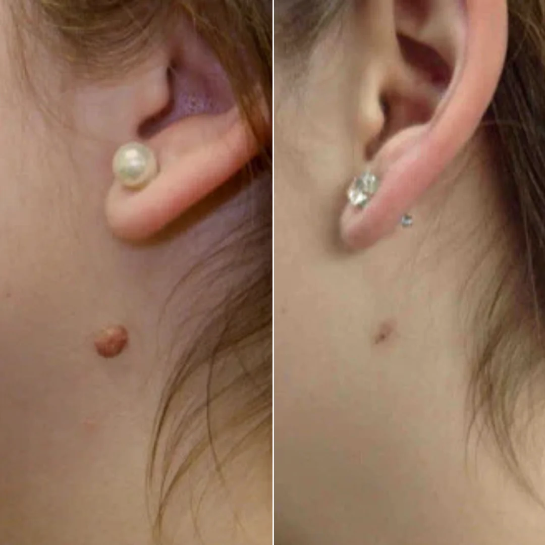 MedOff ™ - Et Beni Temizleme Kiti