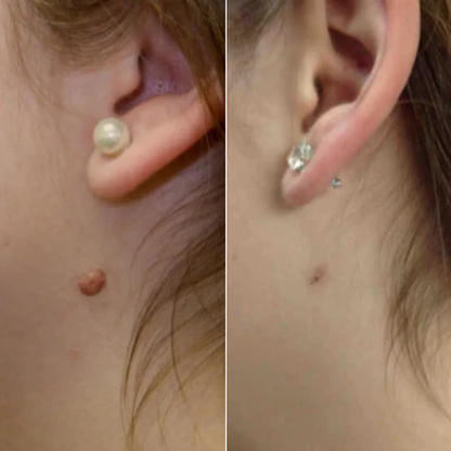 MedOff ™ - Et Beni Temizleme Kiti